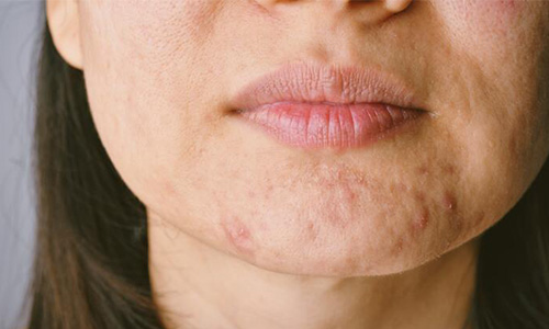 Benefits Aloe Ferox | Aloe Ferox Skin Products